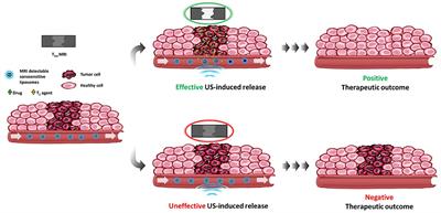 MR-Guided Drug Release From Liposomes Triggered by Thermal and Mechanical Ultrasound-Induced Effects